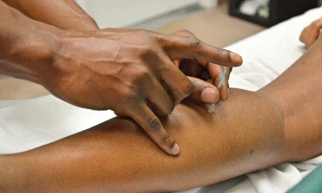 Hvorfor flere og flere mennesker bruger akupunktur